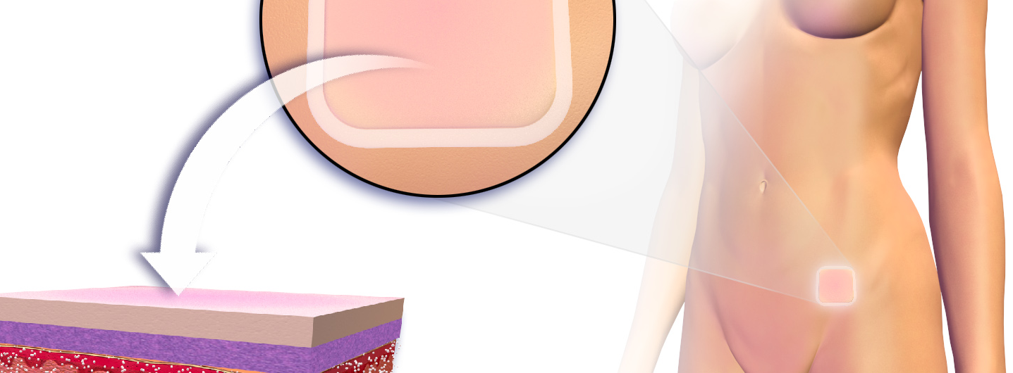 Read more about the article Have You Heard About The Latest Contraceptive Methods?