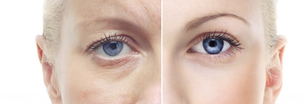 wrinkle skin